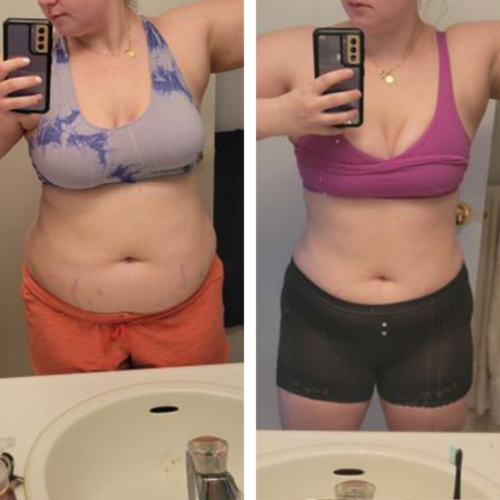 Emily Before and After Picture